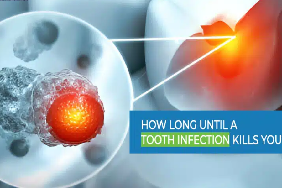 how long until a tooth infection kills you